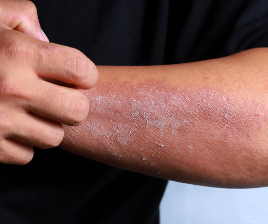 What Is the Skin Barrier? Why It Matters More Than You Think